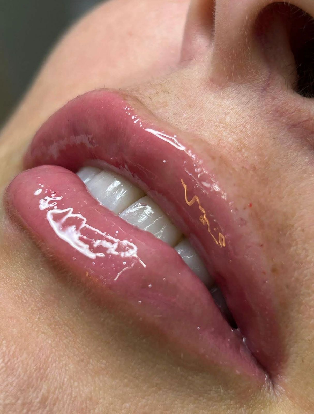 Estética no Espaço La Belle